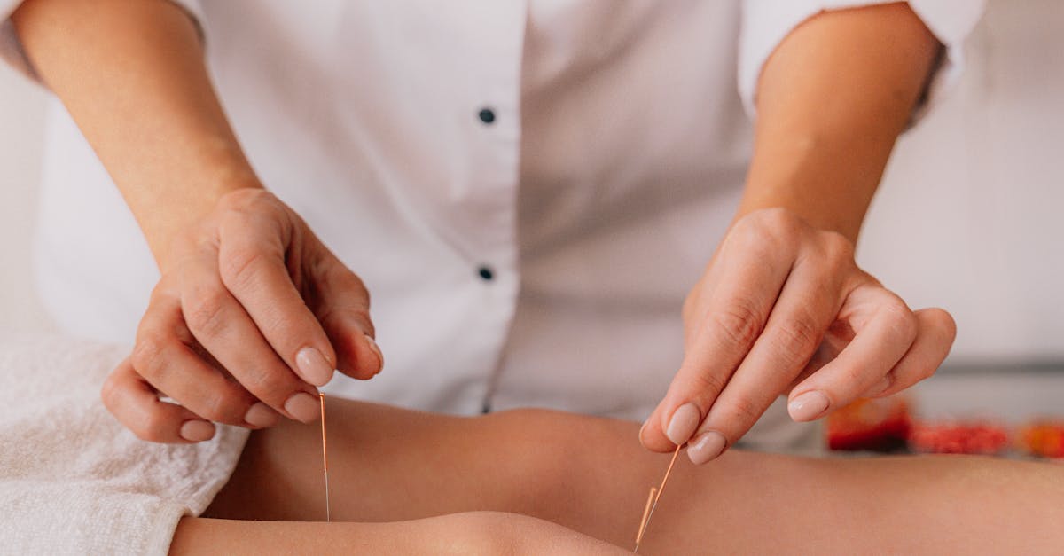 Comparing Dry Needling and Traditional Acupuncture: What You Need to Know
