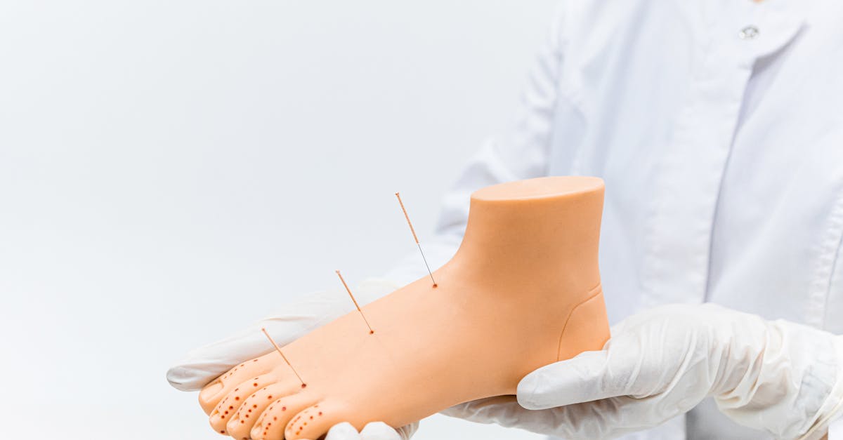 Exploring the Relationship Between Acupuncture and Sleep Improvement