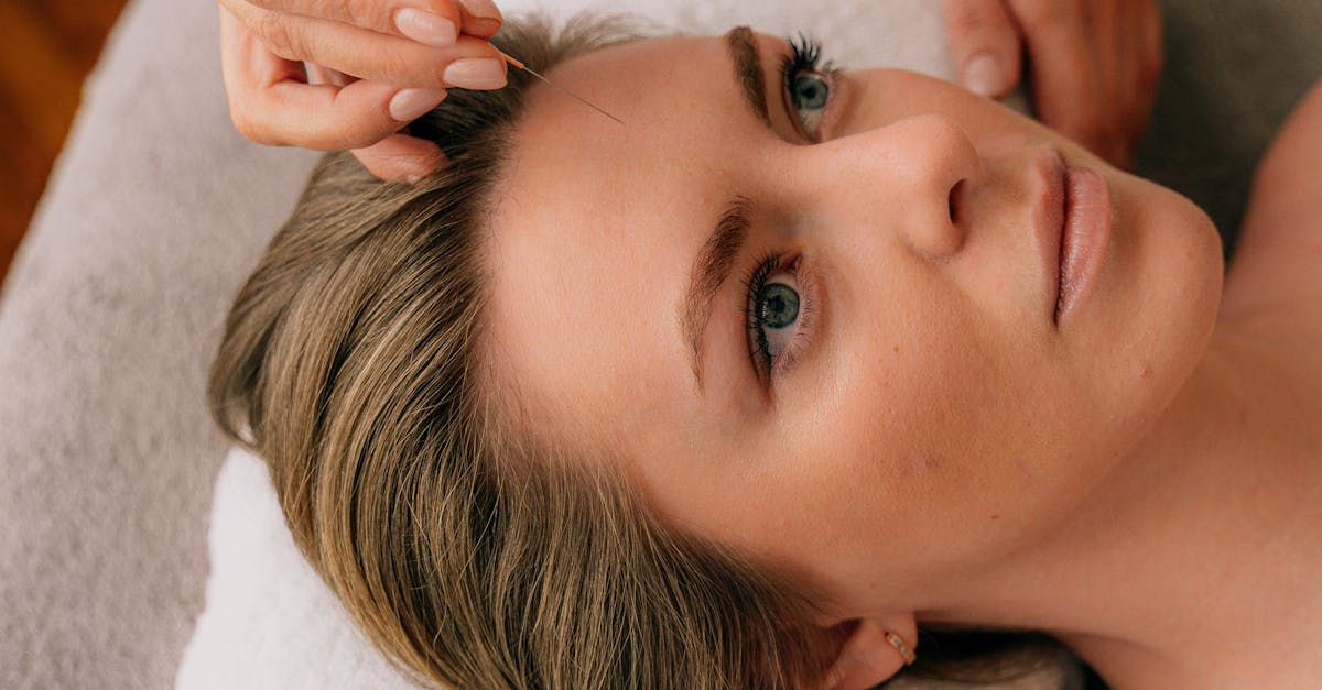 Key Qualifications That Distinguish Professional Acupuncturists