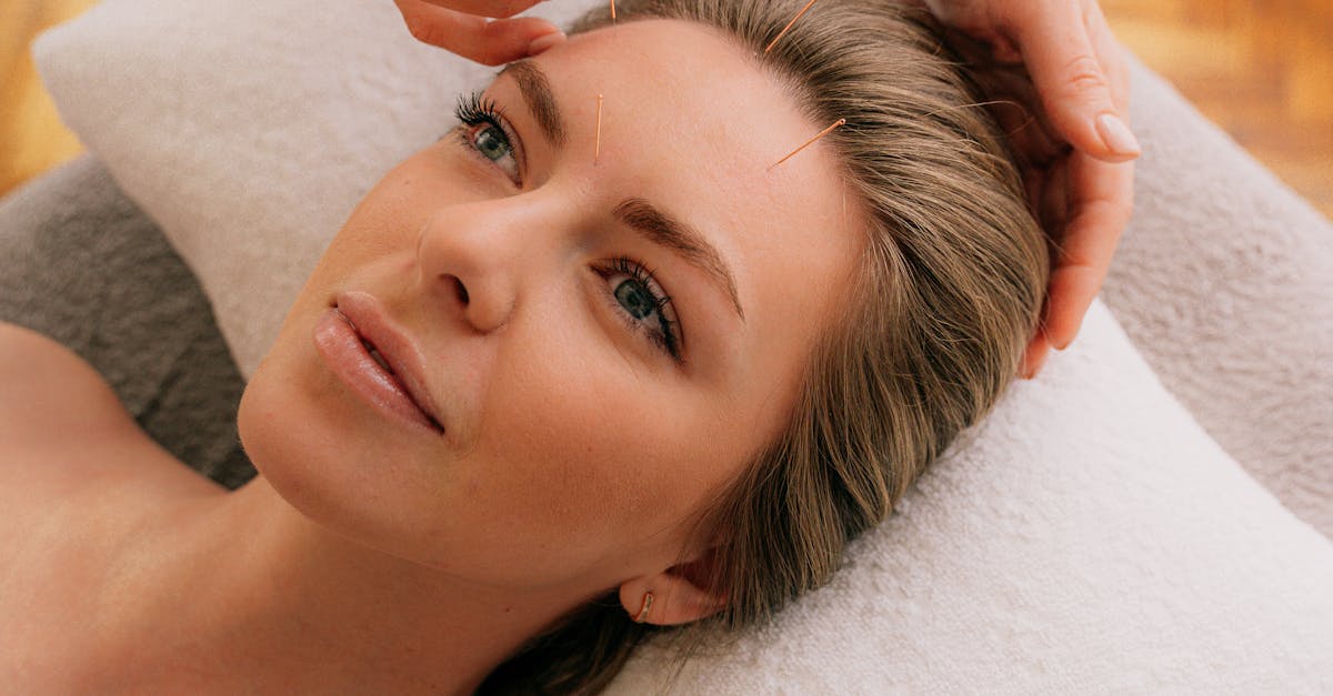 Navigating Melbourne's Acupuncture Scene: Location Insights