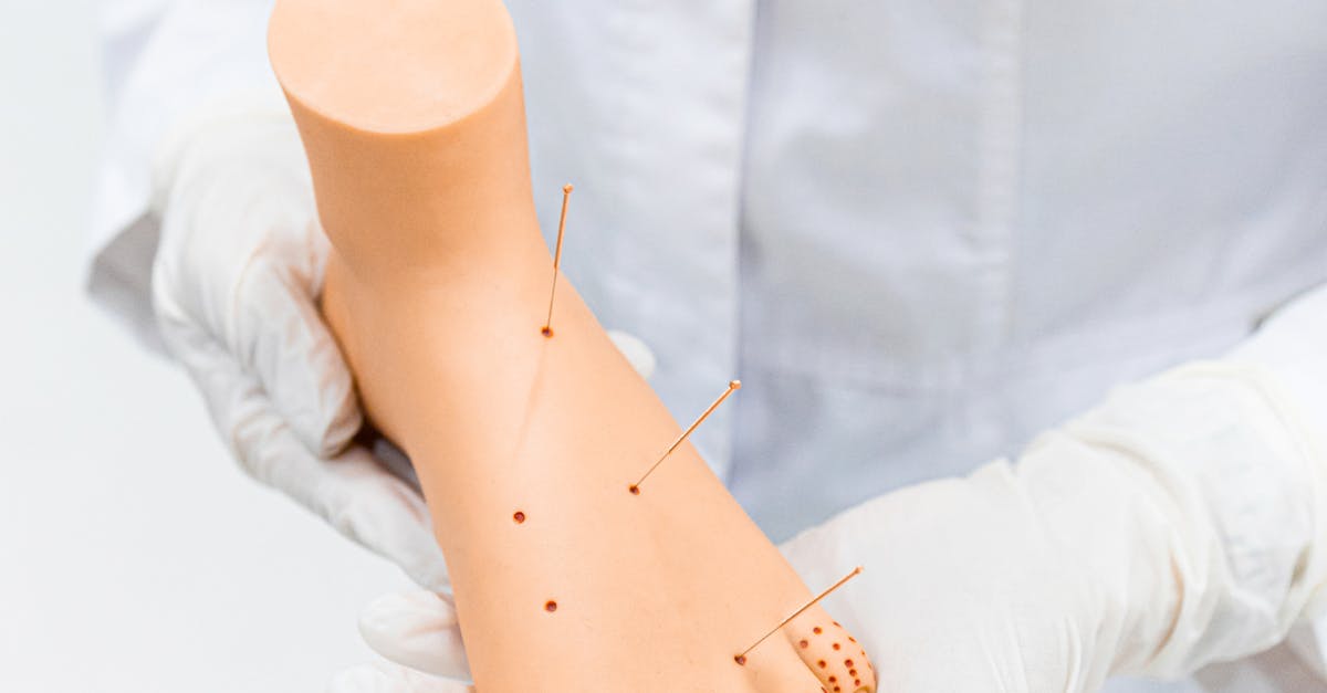The Art of Diagnosis in Traditional Chinese Acupuncture